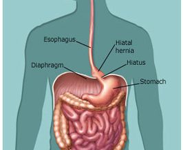 Helibacter Pylori